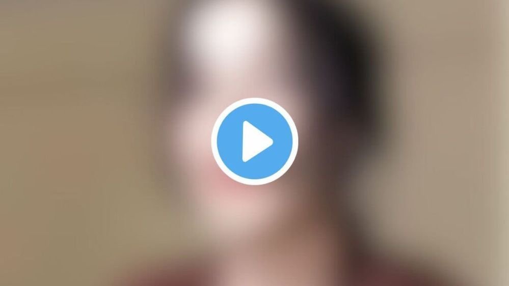 30126456
